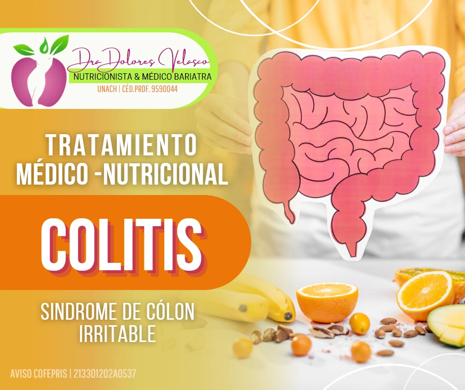 Tratamiento Médico-Nutricional para Colitis y Síndrome de Colon Irritable
