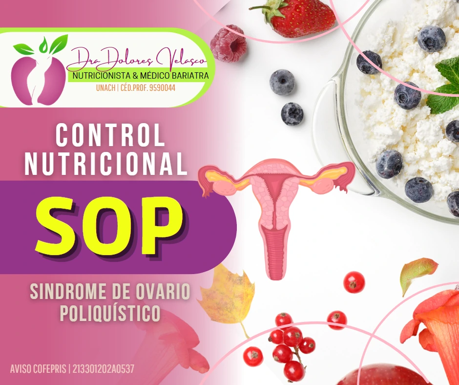 Control Nutricional para Síndrome de Ovario Poliquístico